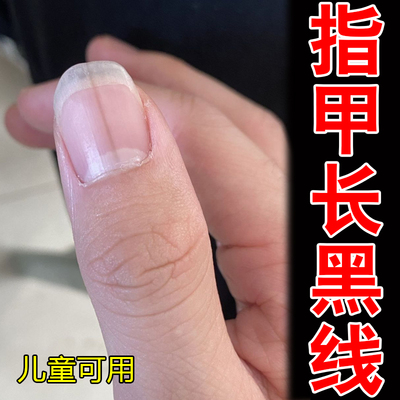 指甲空甲分层有黑线竖纹修护液改善甲面凹凸增厚发黄干枯脆甲滋养