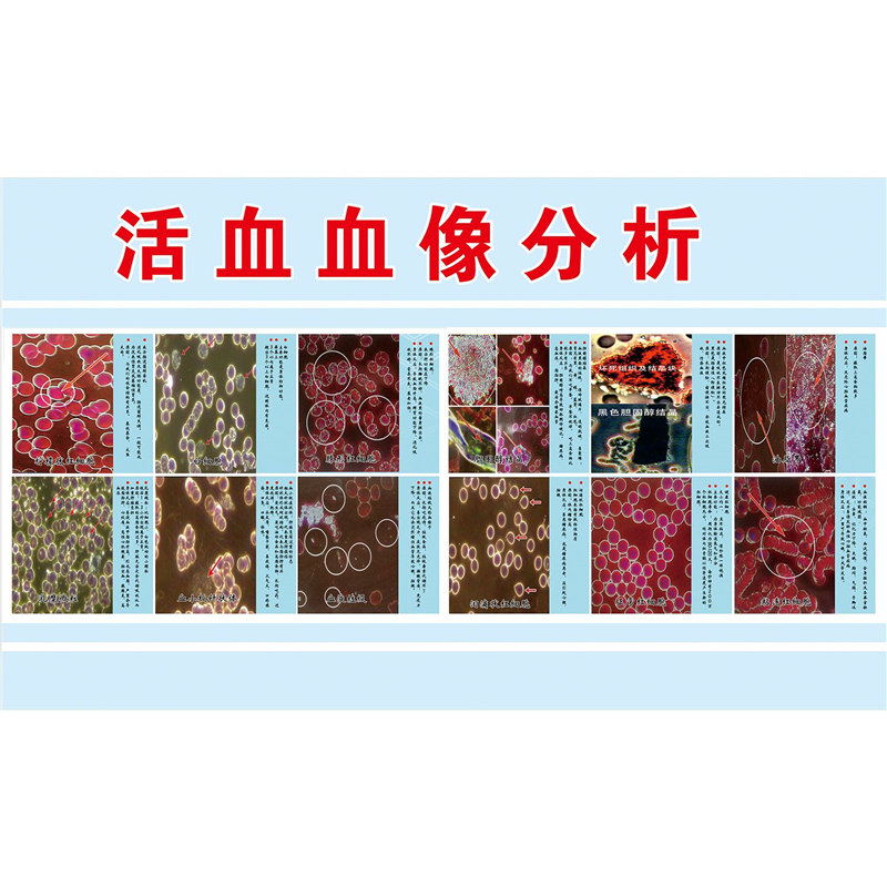 人本血液检测海报活血血像分析图墙上挂图海报印制展板墙贴纸,家居饰品,软装墙贴,淘宝优惠券,粉丝福利购,淘宝优惠卷