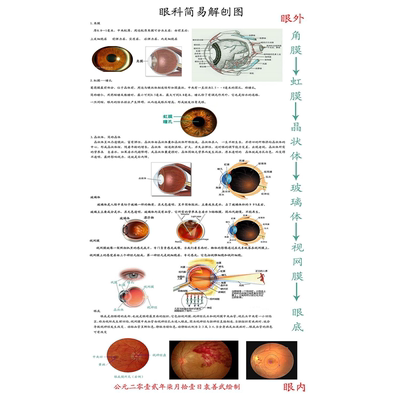 眼科简易解刨图海报展板虹膜是什么眼科简易解剖图墙贴墙纸装饰画