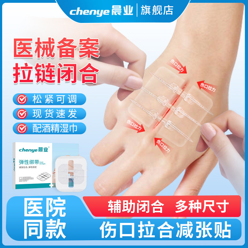 皮肤减张器伤口医用辅助闭合手术剖腹产儿童术后拉链伤口贴减张贴