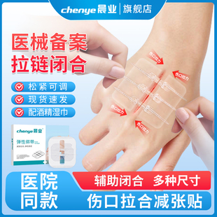 皮肤减张器伤口医用辅助闭合手术剖腹产儿童术后拉链伤口贴减张贴