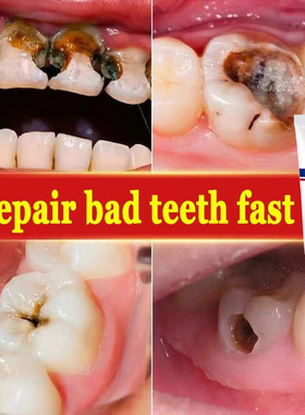 极速Creme dental reparrar rapidamente as gomas, cries, c