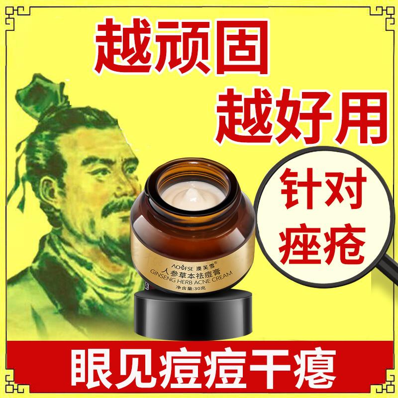 痤疮膏去痘重度暗疮脸上长痘痘用什么药中药去痘膏淋巴痘腮边痘