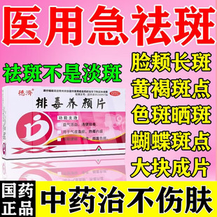 排毒养颜片去祛斑内调祛黄褐斑雀斑专用药内服调理中药搭祛斑胶囊