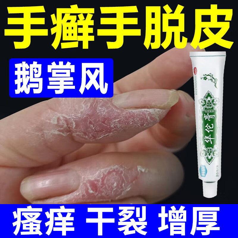 治疗鹅掌风的药手癣手脱皮足癣手掌粗糙开裂真菌感染瘙痒杀菌止痒