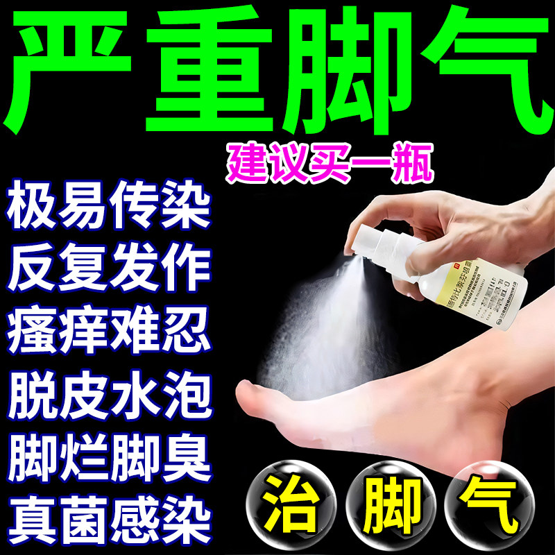 【伊人】盐酸特比萘芬喷雾剂1%*15ml*1瓶/盒