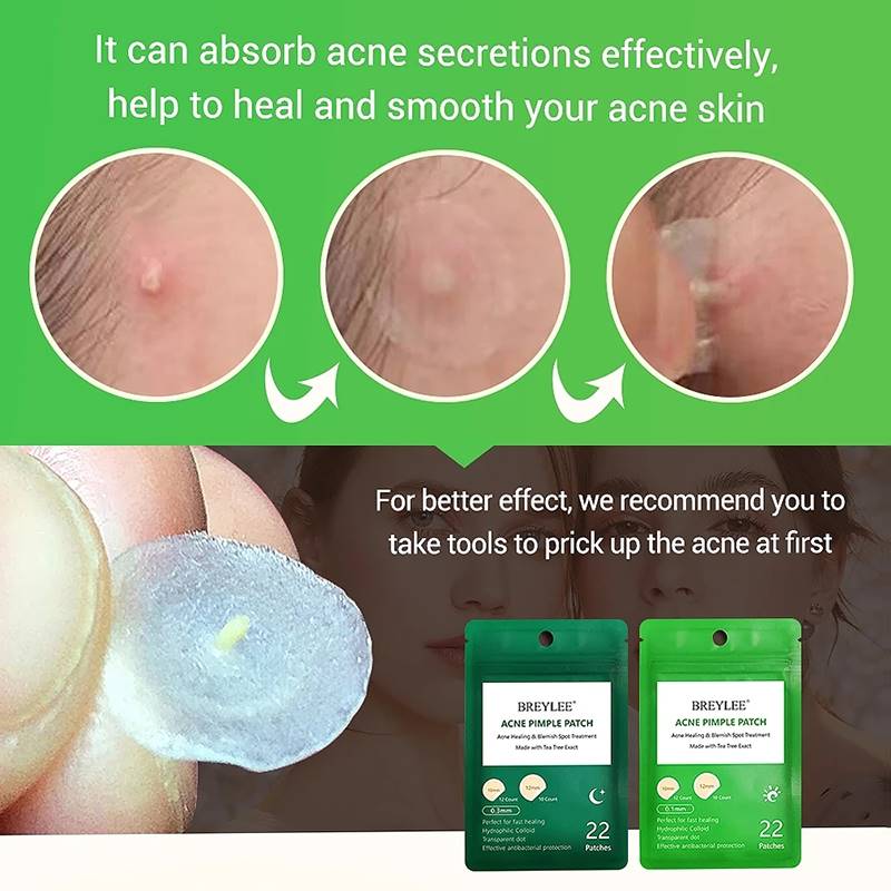 速发BREYLEE Acne Pimple Patch Stickers atment Pimple Remover