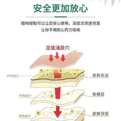 极速耳鸣神经性耳鸣王一周见效耳康药H贴耳朵嗡响耳鸣止鸣神器膏