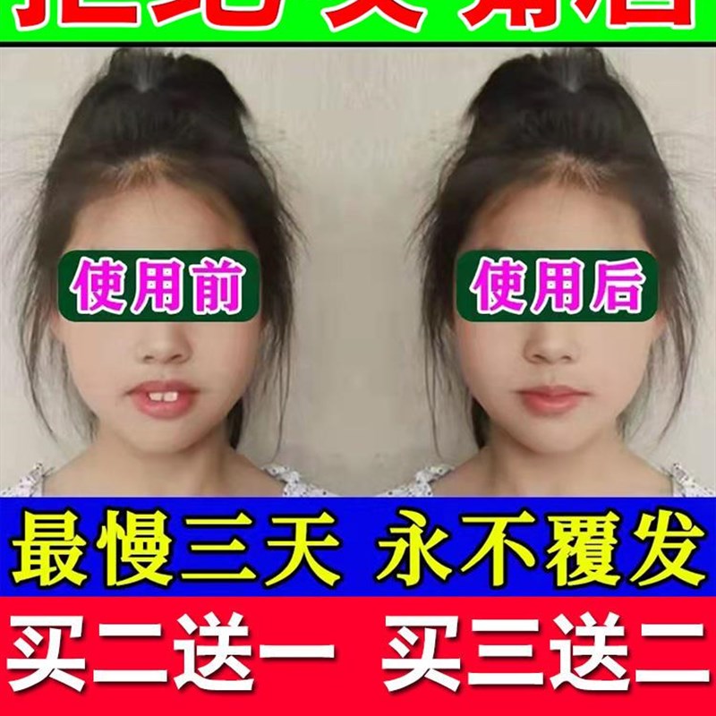 极速防咬下嘴唇纠正器日本戒咬嘴B唇神器改善小孩子口呼吸矫正前