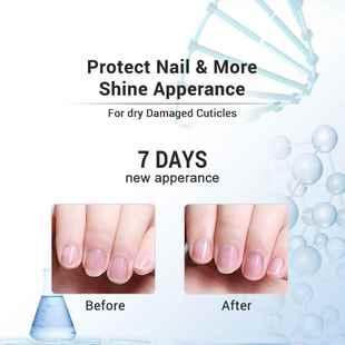 极速New 1d5ml Cuticle Oil 6 Flavor Nail Nourish Care Pure Na