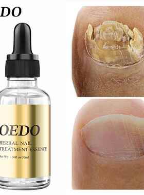 极速OHealthy Nail Care Fungus Nail Repair EssentialW Oil Han