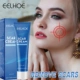 New and Scars Fade Old Cream Marks Acne Repair Surgical Scar