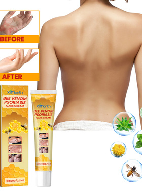 Bee venom cowhide moss ointment for relieving skin redness,