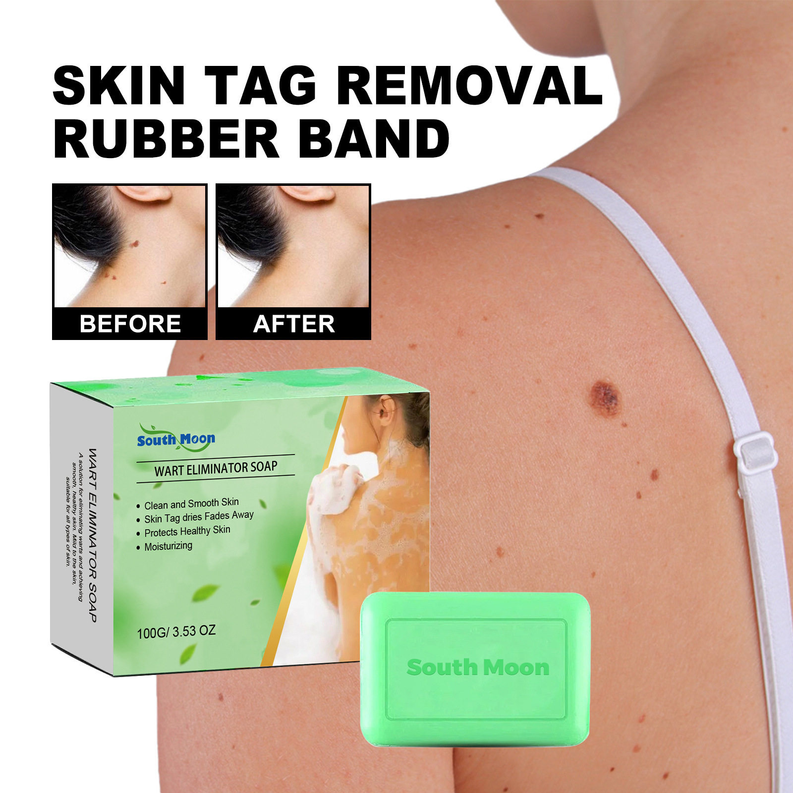 SouthMoon克疣香皂去痣脸部颈部