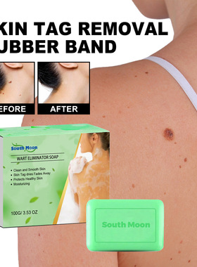 Ke wart soap for removing nevus Ke wart facial and neck fles