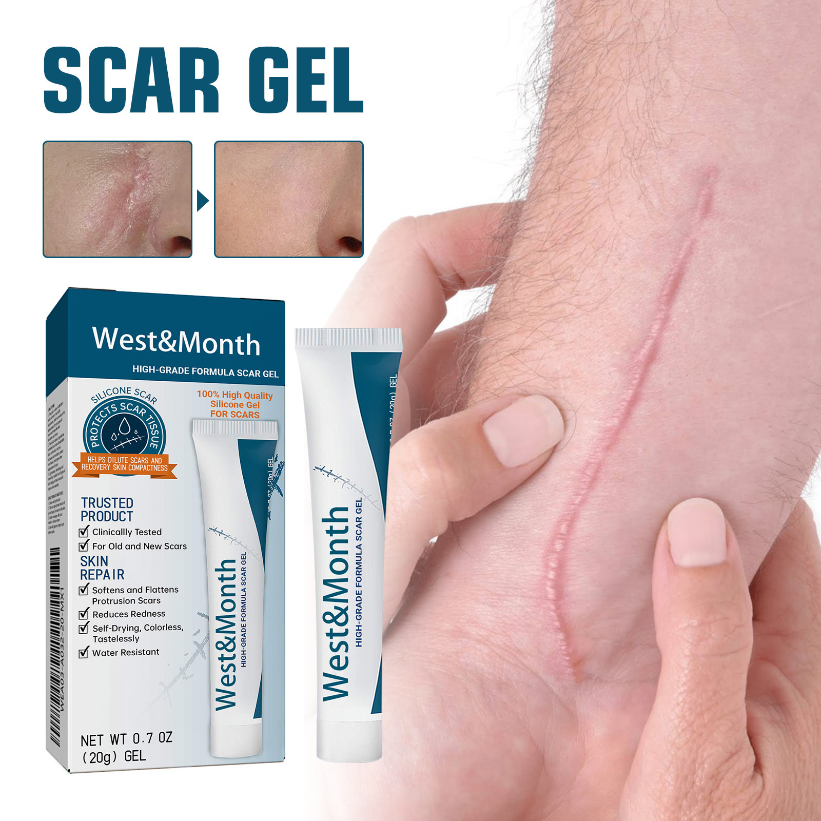 West&Month淡化疤痕凝胶修护手术