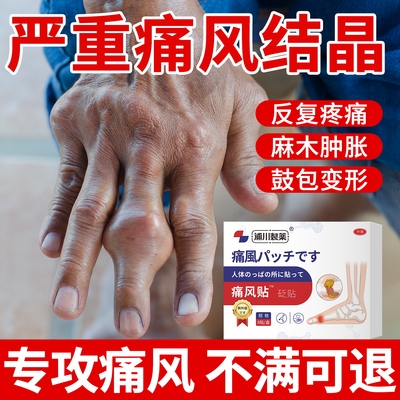 痛风性关节炎痛风止痛溶石贴膏痛风特痛风贴降尿酸溶石去结晶效
