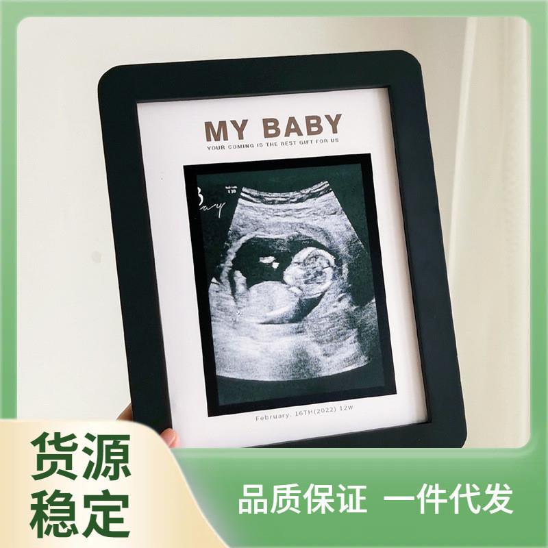 FII4精品B超相框四维彩超照片宝宝三维孕妇孕检早期24周照片婴儿