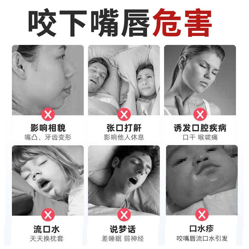 极速宝宝防咬下j嘴唇纠正器戒咬嘴唇y神器改善小孩子口呼吸矫正前