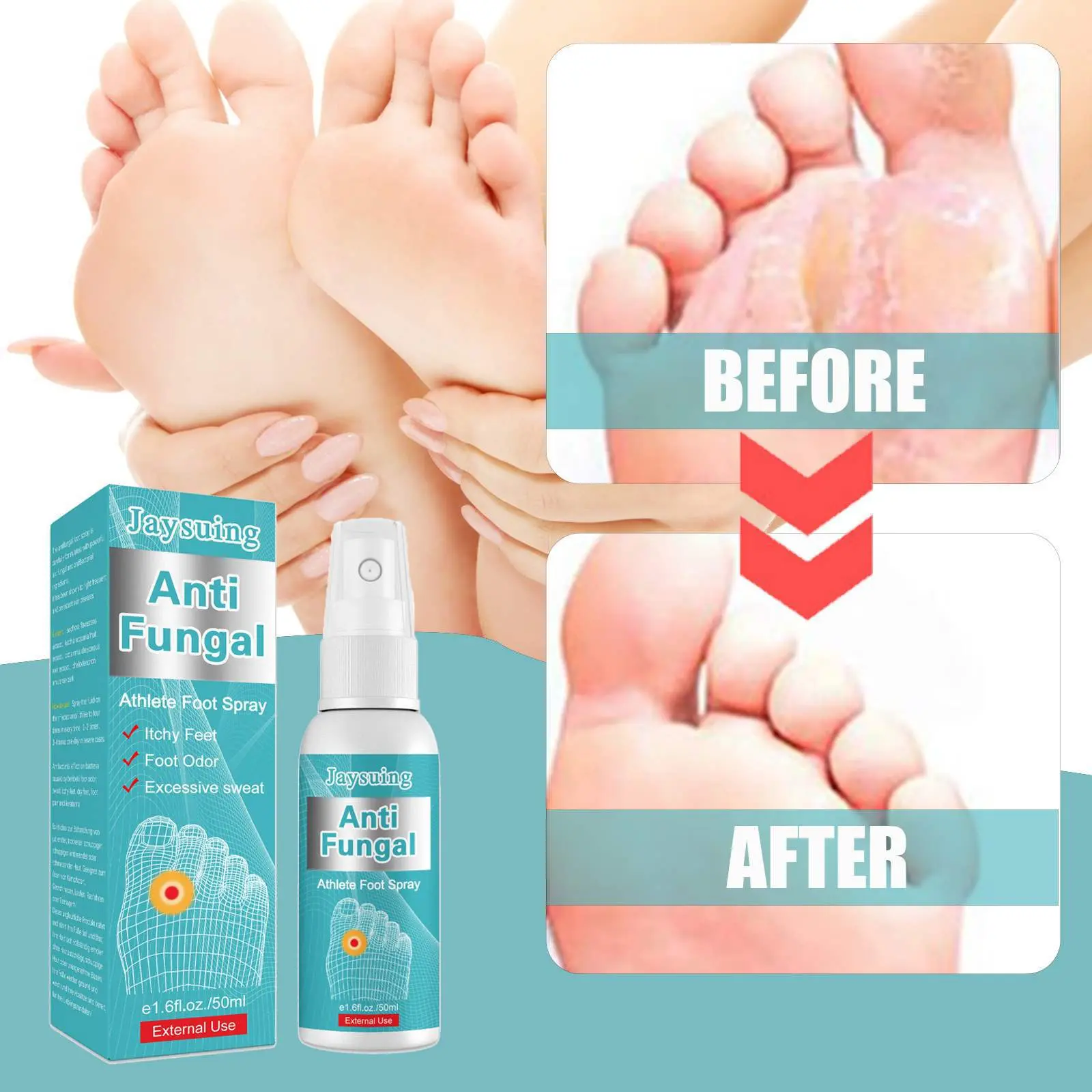 运动员足部护理喷雾脚臭脚痒脚汗