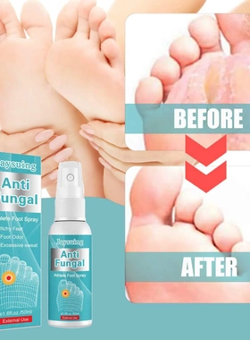 Athletic Foot Care Spray Smelly Feet Itchy Sweaty Rotten Fee
