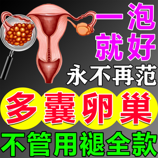 多囊卵巢综合征调理内分泌失调肥胖月经量少闭停促排卵助孕泡脚包