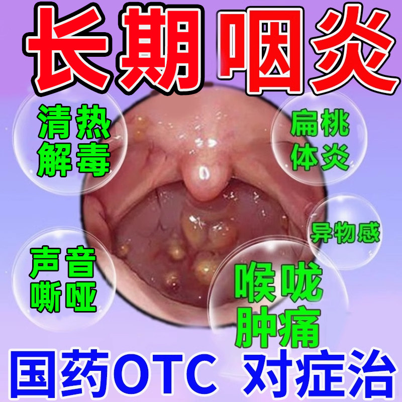 咽喉炎特疼痛效药咽喉肿痛喉咙发炎有异物感慢性咽炎专用冬凌草片
