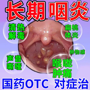 咽喉炎特疼痛效药咽喉肿痛喉咙发炎有异物感慢性咽炎专用冬凌草片