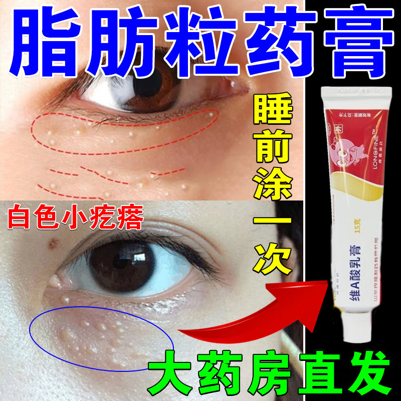 脂肪粒药膏眼部疙瘩眼周脂肪粒油脂粒白色颗粒医用正品维A酸乳膏