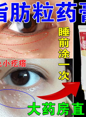脂肪粒药膏眼部疙瘩眼周脂肪粒油脂粒白色颗粒医用正品维A酸乳膏