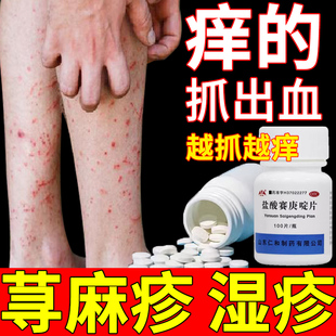 盐酸赛庚啶片治皮肤身上瘙痒 口服药寻荨麻疹过敏止痒皮肤专用药
