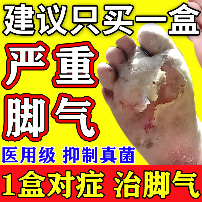 【伊人】盐酸特比萘芬喷雾剂1%*15ml*1瓶/盒
