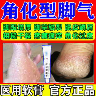 水杨酸软膏正品角化型脚气软化角质止痒脱皮去鸡眼足癣药