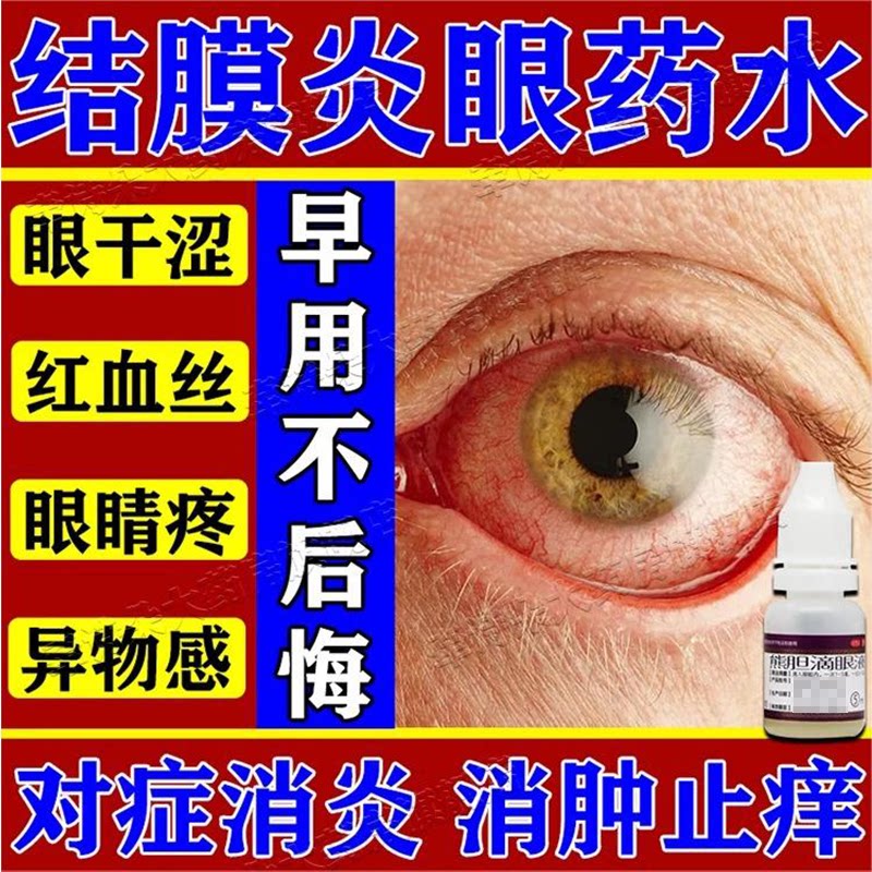 熊胆滴眼液治疗结膜炎水眼睛干涩疲劳模糊发红杀菌止痒眼液药水
