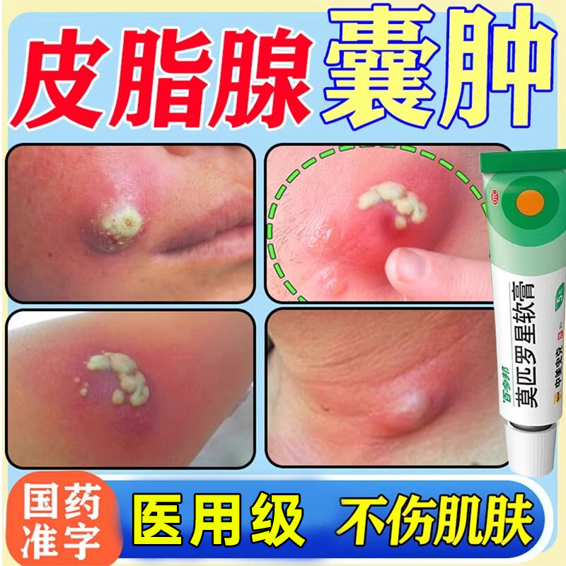 【匹得邦】莫匹罗星软膏2%*10g*1支/盒