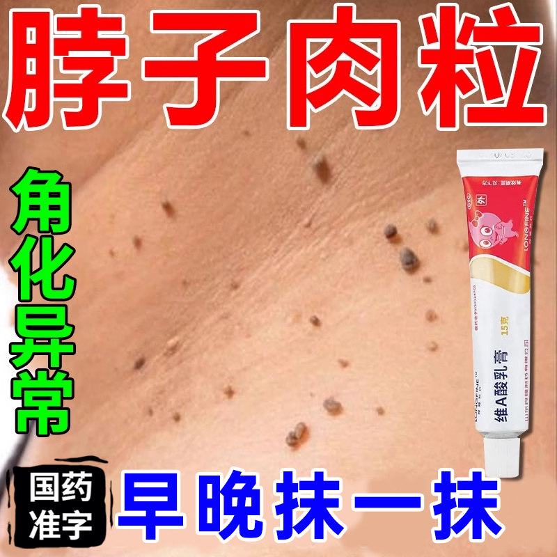 【韩都】维A酸乳膏0.1%*15g*1支/盒