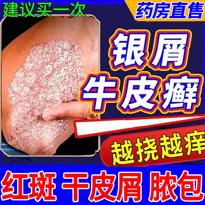 【松华】华佗膏20克/支