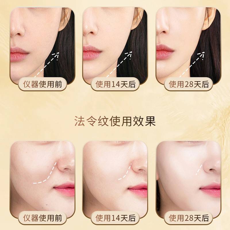 Ai致Fi家红用蓝面眼跳部器美容无品牌/仪光脸拉部仪提紧按摩仪部