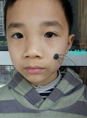 肉色硅胶假痣搞笑演出表演道具媒婆痣痦子肉瘊子扮丑化妆通用黑色