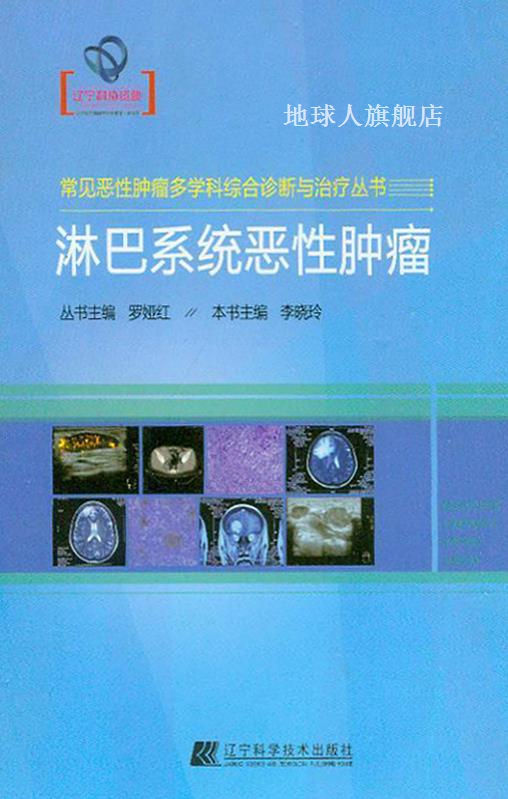 常见恶性肿瘤多学科综合诊断与治疗丛书  淋巴系统恶性肿瘤,李晓