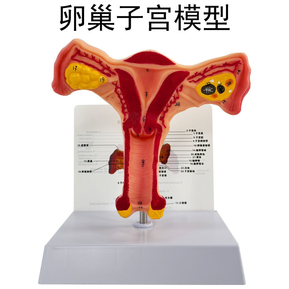 人体子宫模型教学模具阴道卵巢模型病理变化科学教具女性生殖模型