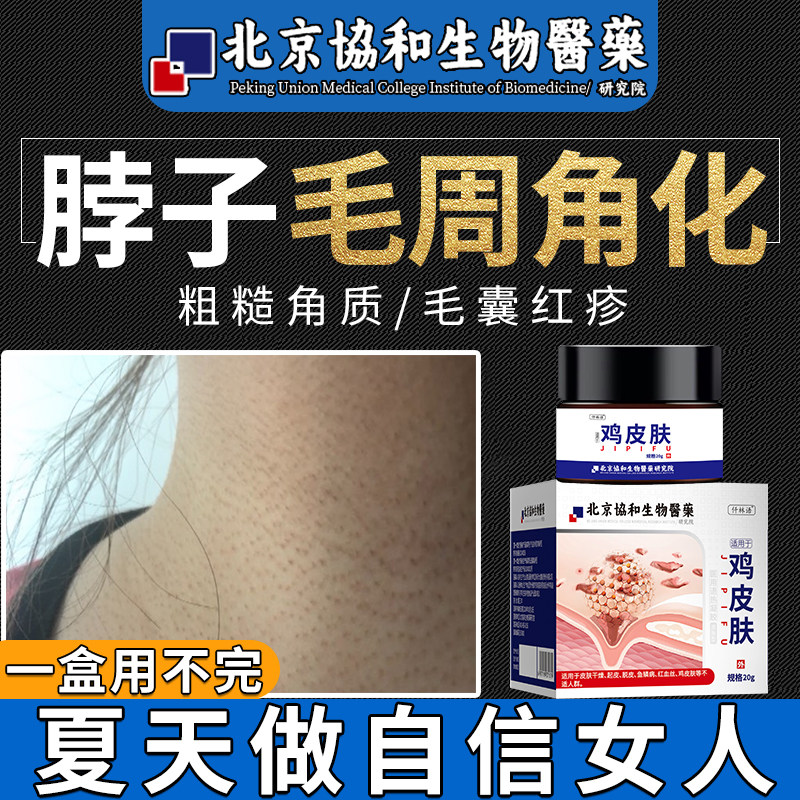 脖子毛周角化症鸡皮肤膏小疙瘩去除毛孔堵塞疏通毛囊可搭膏药贴kj