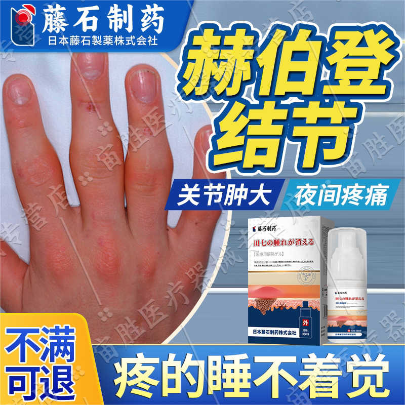 赫伯登结节晨起关节僵硬手指关节肿大畸形专用消肿止痛喷剂lt
