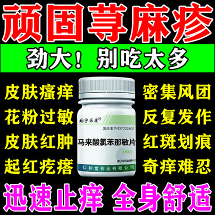 荨麻疹过敏进口止痒专用药皮肤瘙痒红点红斑疙瘩马来酸氯苯那敏片