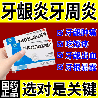 甲硝唑牙周炎片治牙痛专用药牙疼止疼药速效消炎止痛牙龈肿痛药贴