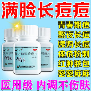 祛痘药祛脓包痘清热解毒内服中药清痘主治玫瑰痤疮复方珍珠暗疮片