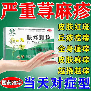 肤痒颗粒官方旗舰店寻荨麻疹过敏止痒断痒根专用药过敏皮肤瘙痒药
