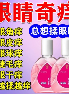 眼痒眼药水眼睛痒眼角发痒总揉眼痒止痒结膜炎过敏性红血丝异物感