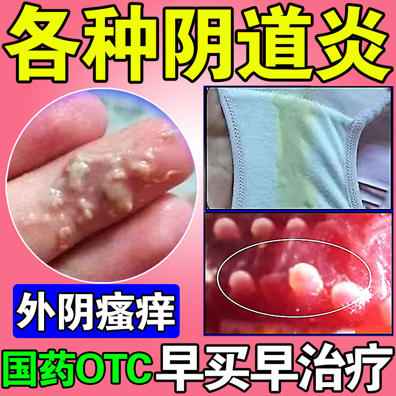 [爱弥尔]甲硝唑阴道泡腾片0.2g*14片/盒