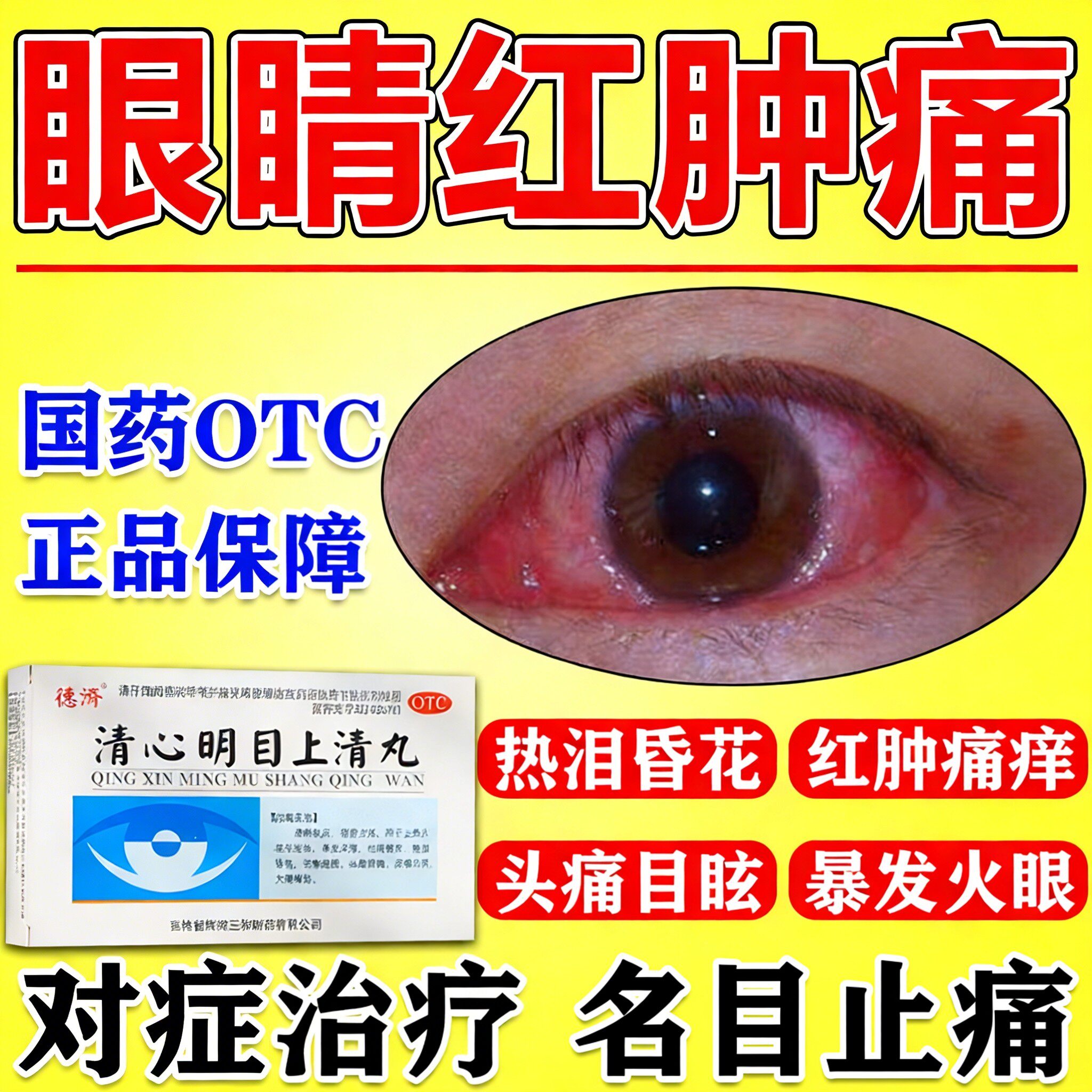 眼睛干涩疲劳模糊看不清红肿痛痒头晕目眩暴发火眼红肿痛痒头痛药